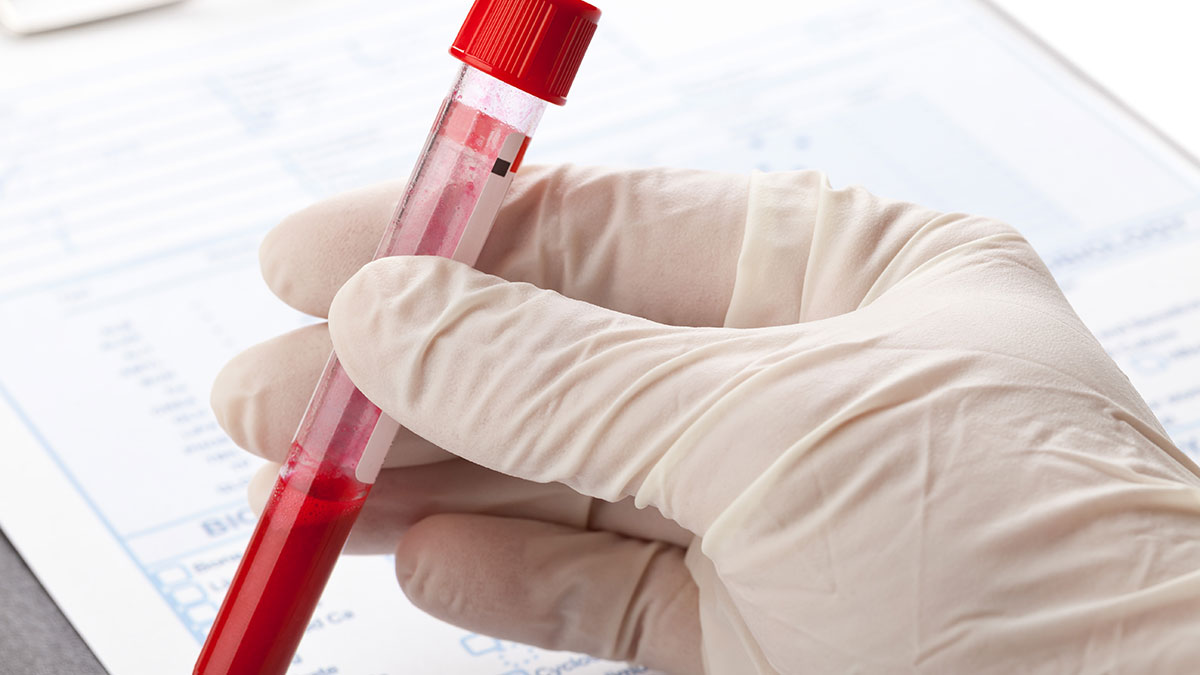 Απλό τεστ αίματος εντοπίζει όσους κινδυνεύουν από καρδιά