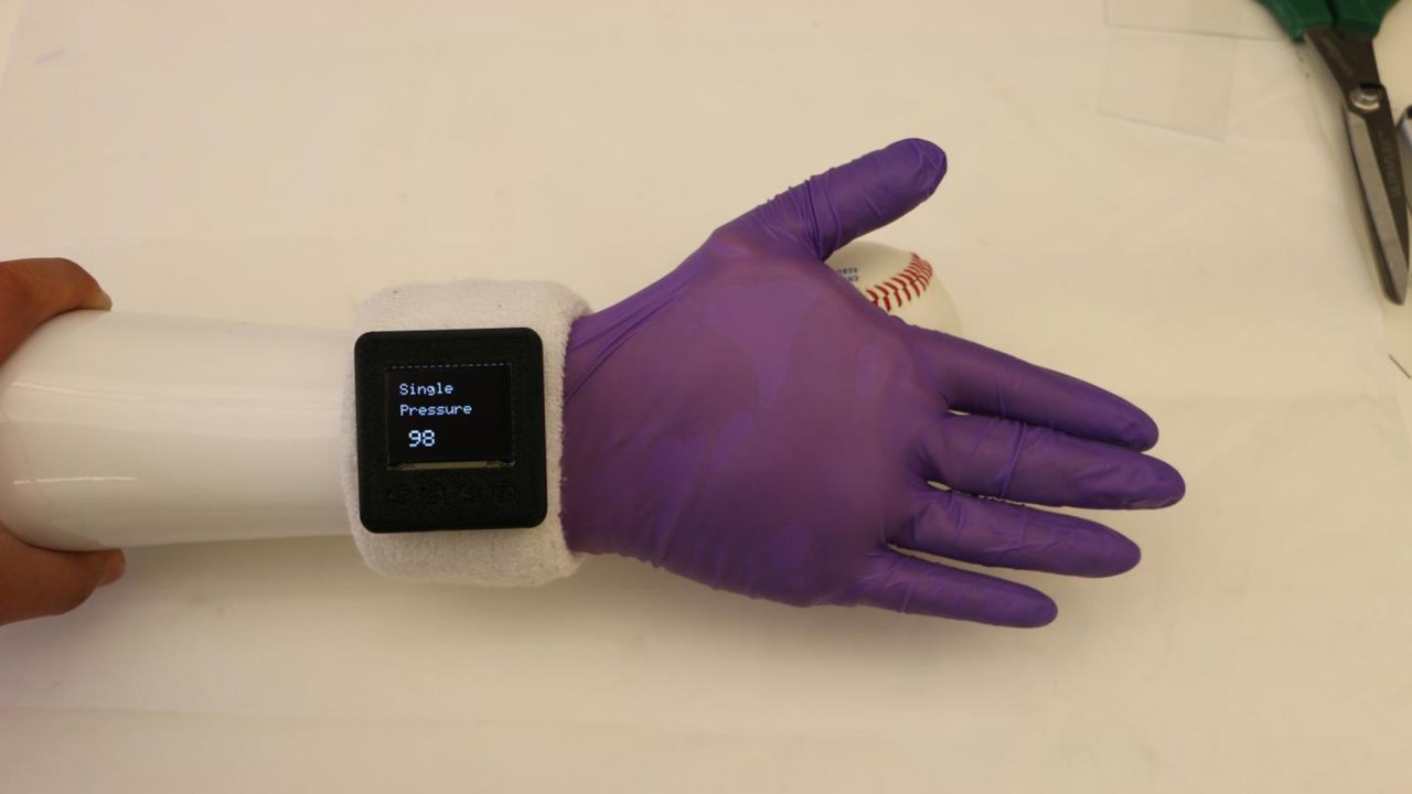 Ηλεκτρονικό γάντι προσφέρει φυσική αίσθηση σε ανθρώπους με πρόσθετο χέρι