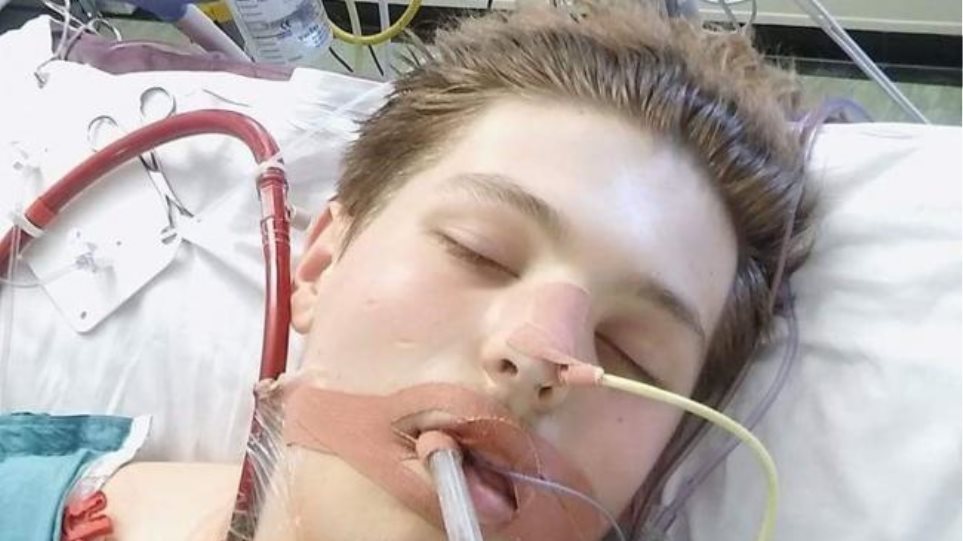 Βρετανία: Ένας έφηβος παραλίγο να πεθάνει λόγω ατμίσματος – Κατέρρευσαν μέσα σε μήνες οι πνεύμονές του