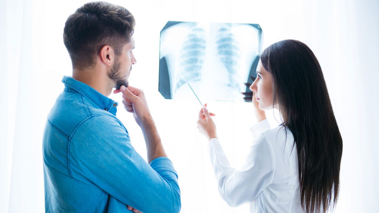 Καρκίνος του πνεύμονα: Τι πρέπει να γνωρίζω