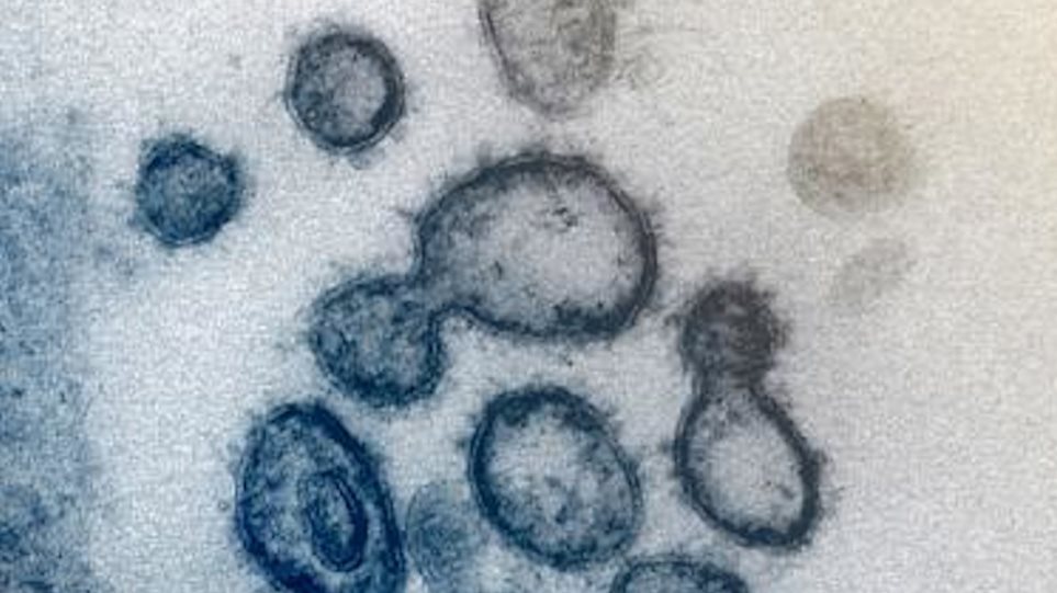 Κορωνοϊός: Επιστήμονες «φωτογράφισαν» τον Covid-19 – Οι πρώτες εικόνες από μικροσκόπιο