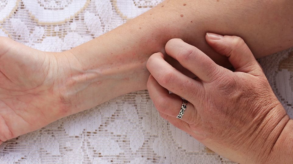 Κορωνοϊός: Τελικά πόση ώρα παραμένει στο δέρμα μας; – «Κλειδί» το πλύσιμο των χεριών