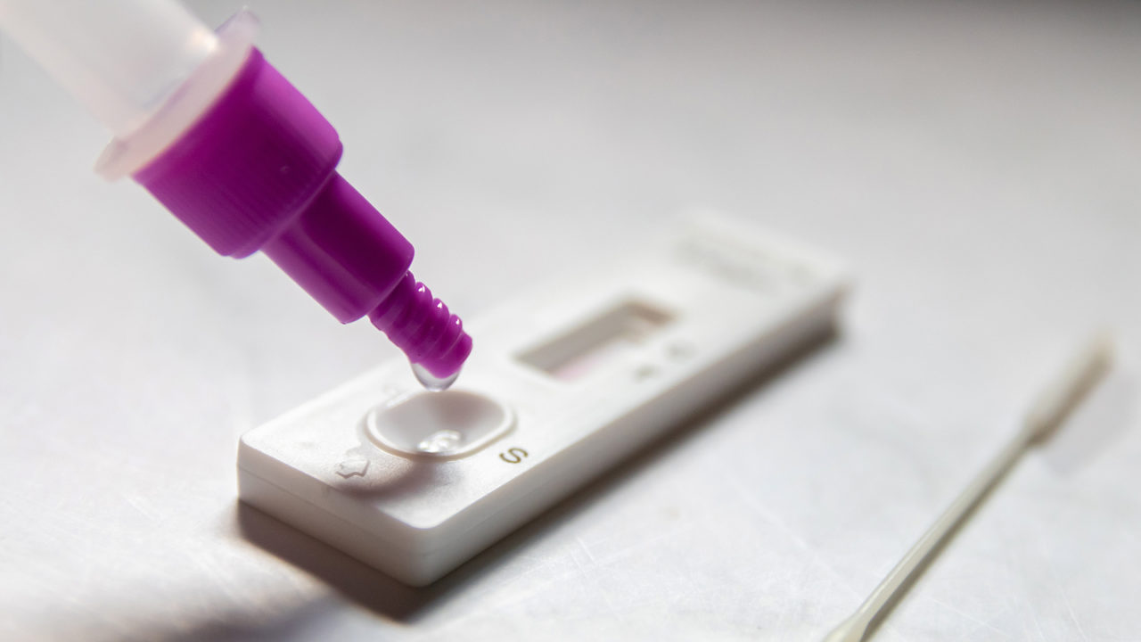 Κορωνοϊός: Επιστήμονες δημιουργούν νέο PCR test που ανιχνεύει τις μεταλλάξεις