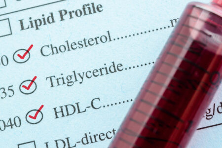 Χοληστερόλη: Πώς επιδεινώνει φλεγμονή και ιώσεις