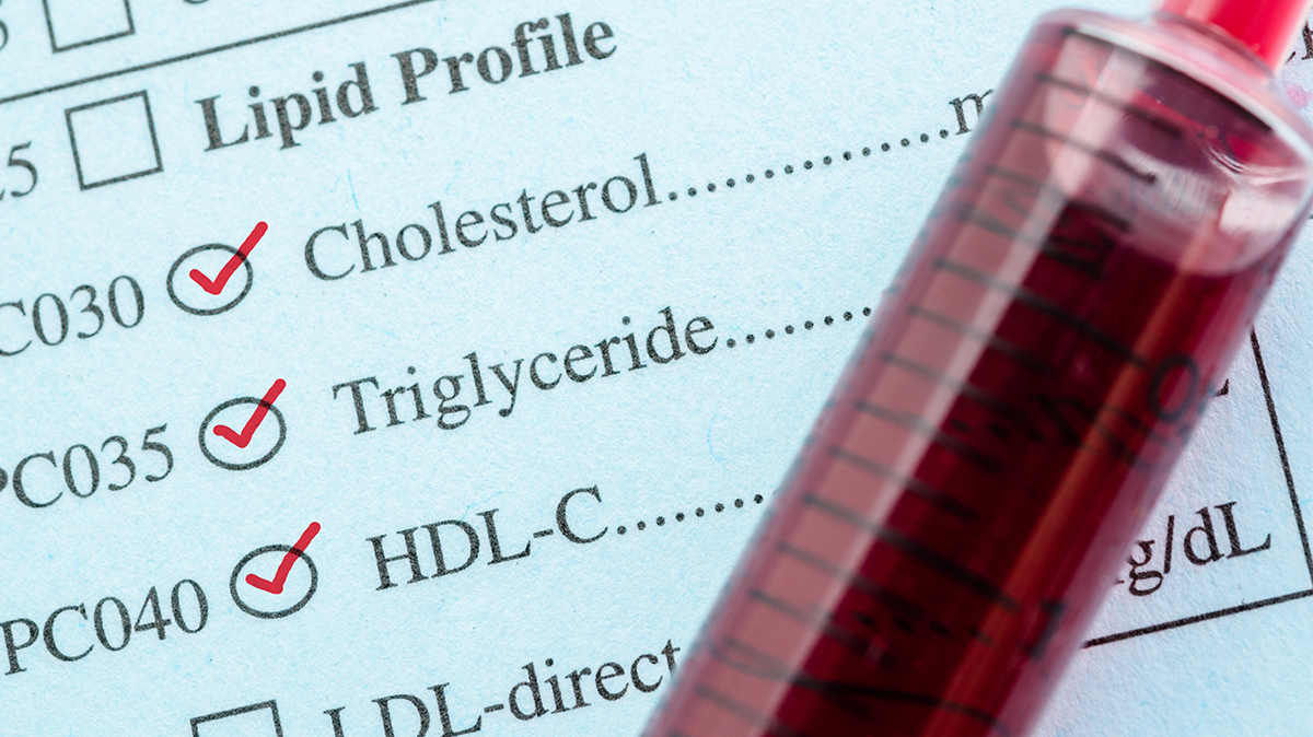 Χοληστερόλη: Πώς επιδεινώνει φλεγμονή και ιώσεις