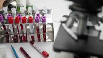 Κορωνοϊός: Νέο τεστ ανιχνεύει τα αντισώματα στα ούρα και όχι στο αίμα