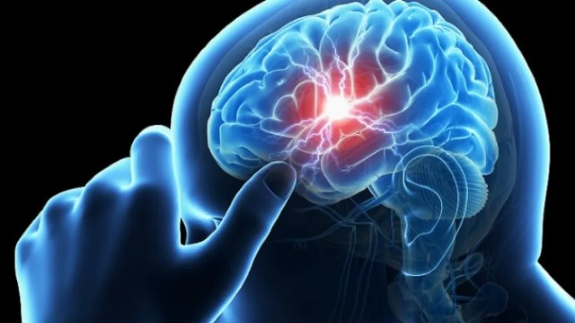 Εγκεφαλικά επεισόδια – Θρομβεκτομή: Η σωτήρια επέμβαση για την αντιμετώπιση